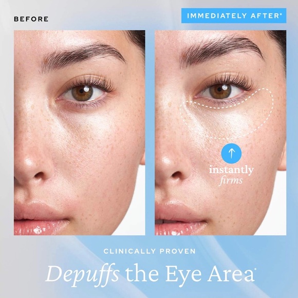 💦NWT💦 BELIF Aqua Bomb Depuffing Eye Gel with Caffeine + Hyaluronic Acid 5ml - Picture 4 of 9